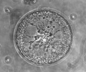 Coscinodiscus gigas