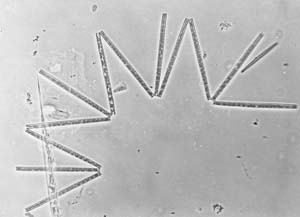 Thalasionema
                nitzschioides
