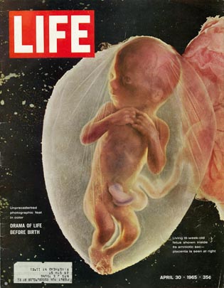 Lennart Nilsson "1965
                Life"